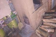 Термические ожоги тела: в Калинковичах серьезно пострадала девочка