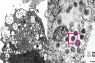 Ученые из Гонконга опубликовали первую фотографию «омикрона»