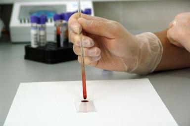 Учёные установили, с какой группой крови люди живут дольше
