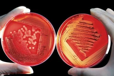Ученые: Клетки бактерий могут переходить в режим зомби