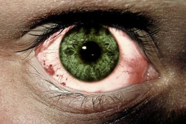 Медики рассказали, чем опасно покраснение глаз