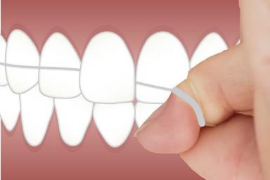 Медики объяснили, чем может быть опасна зубная нить