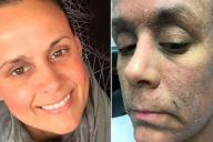 Женщина стала «зомби». Использовала не тот крем для кожи 