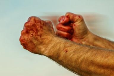В Речицком районе украинец избил будущего тестя костылем и ножкой от стола