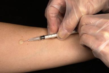 Ученые придумали новую вакцину от туберкулеза