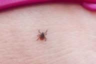 Мальчик из Слонимского района заболел клещевым энцефалитом