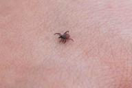 Более 20 жителей Гомельской области пострадали от укусов клещей с начала года