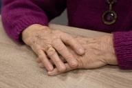 Ученые рассказали, о каких болезнях могут говорить морщины