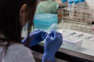 Специалисты составили список ранних симптомов рака