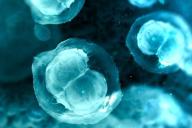 Ученые: лечение стволовыми клетками эффективно 