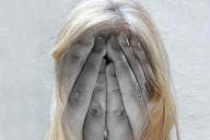 Школьница полтора года просыпается, не помня, что было вчера, из-за травмы