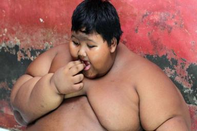 Родители самого толстого ребенка в мире не сразу заметили, что у сына проблемы с весом