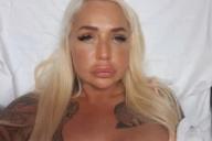 Звезда фильмов для взрослых попала в больницу после увеличения губ и была осмеяна в Сети