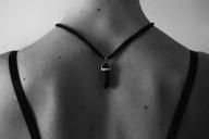 Как определить, что родинка опасна: советы врачей 