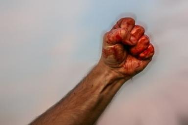 В Шумилино пьяный хулиган голыми руками разбил 5 окон на складе