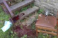 В кабинете стоматолога разыгралась кровавая драма: медику перерезали вены