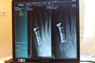 Ученые опровергли 5 мифов о рентгене