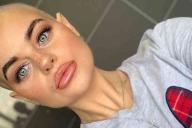 «Крем для тела спас мне жизнь». Девушка сама обнаружила у себя рак, который не нашли врачи