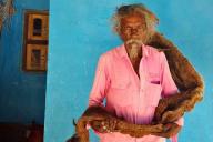 Мужчина 40 лет не стриг волосы и не мыл голову. Вот к чему это привело 