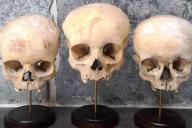 Продаю череп, недорого. Как устроен рынок человеческих останков в Instagram