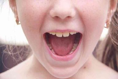 Во рту у мальчика нашли 526 лишних зубов