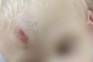 В Минске велосипедист на глазах у матери сбил ребёнка и поехал дальше