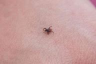 В Минске увеличилось количество обращений за медпомощью из-за укусов клещей