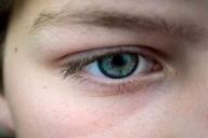 Ребёнок едва не лишился зрения из-за обычного герпеса