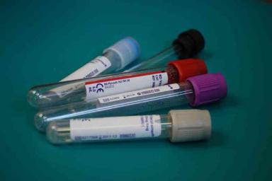 Ученые выяснили, какая группа крови защищена от онкологии