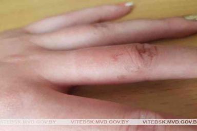 В Витебске за разбой задержали 25-летнюю девушку: угрожая ножом, отобрала у знакомой золотые украшения