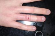 В Гомеле юноша оказался заложником украшения