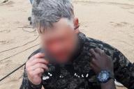 Мужчина выстрелил себе в голову гарпуном и выжил 