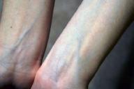 Создана технология распознавания людей по виду их вен на руках