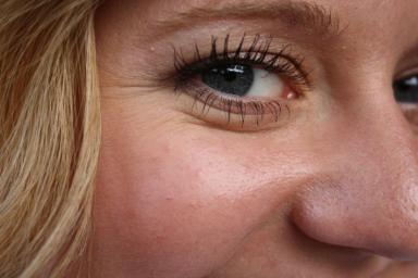Косметологи рассказали о причинах возникновения морщин вокруг глаз