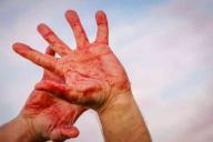 «Пришёл домой уже побитый»: В Сморгони женщина избила сожителя – он в коме