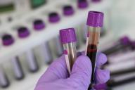 Ученые выяснили, какие группы крови притягивают болезни