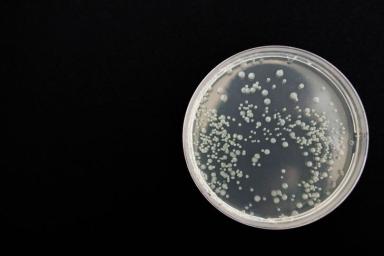 Идентифицирована новая бактерия в атмосфере Земли