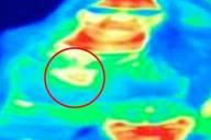 Поход в музей помог женщине распознать смертельную болезнь