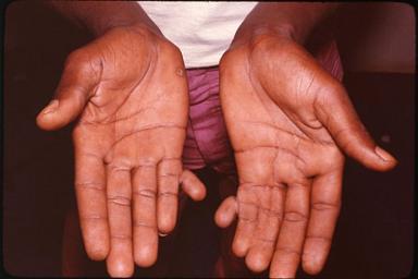 Учёные установили, что людям недостаёт шестого пальца на руках