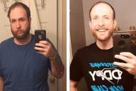 Такого не ожидал никто. Парень показал, как изменился за три года без алкоголя